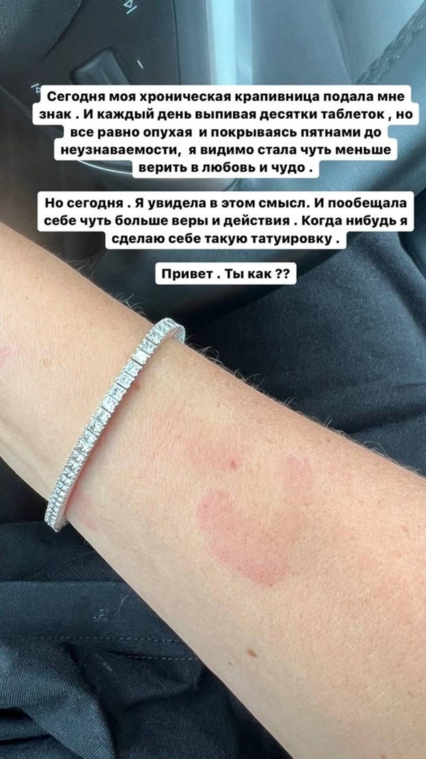 Анна Седокова поделилась своими проблемами
