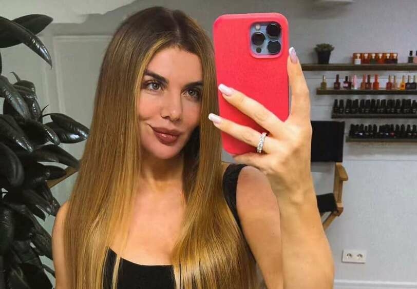 Анна Седокова «превратилась в Шрека»: шокирующие фото певицы