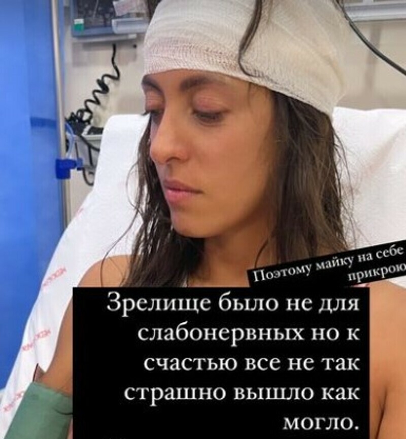 Актриса получила серьезную травму головы