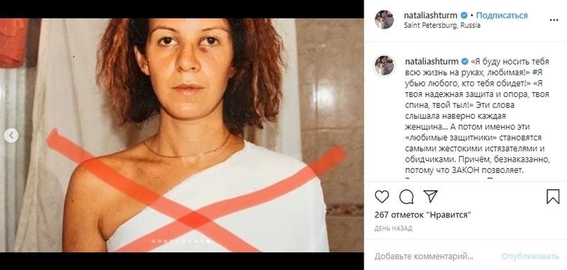 Наталья Штурм показала свое лицо после побоев бывшего мужа