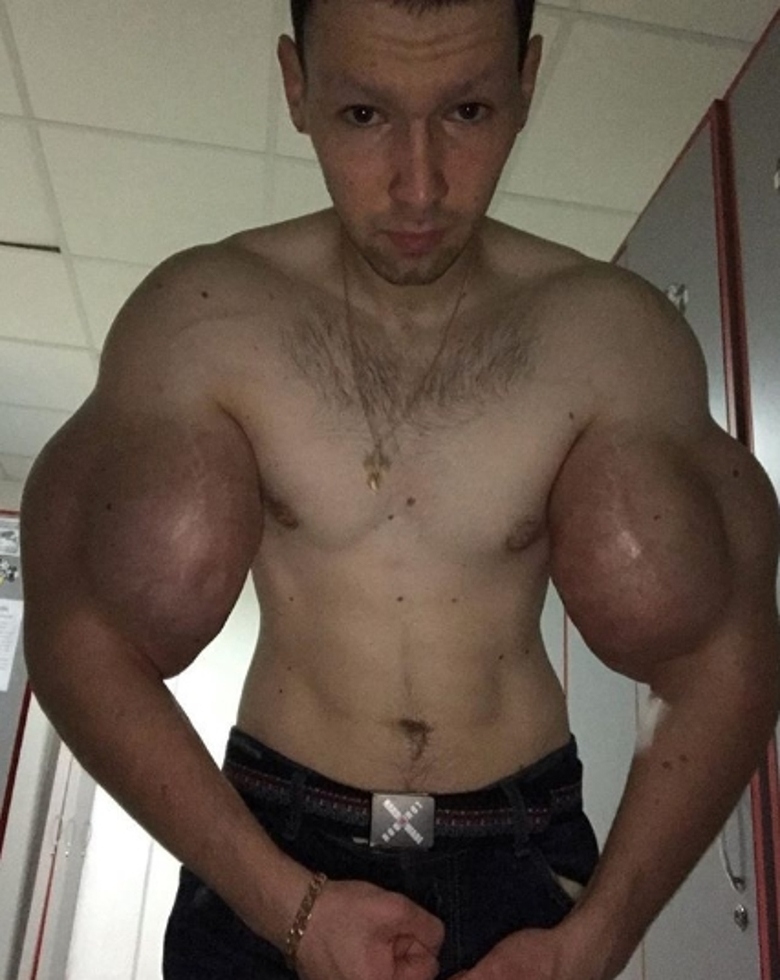 «Руки-базуки» Кирилл Терешин