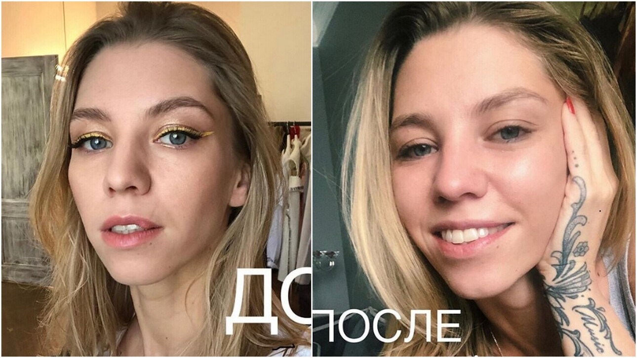 Собака укусила дочь Салтыковой за лицо