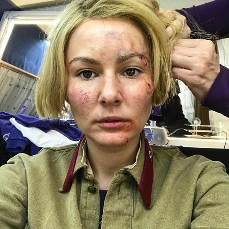 Мария Кожевникова напугала поклонников ужасным видом